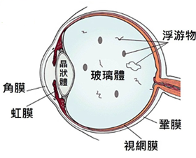 飞蚊